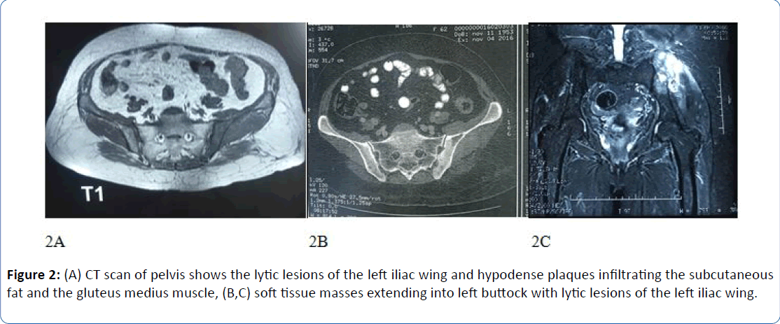 archivesofmedicine-pelvis-shows